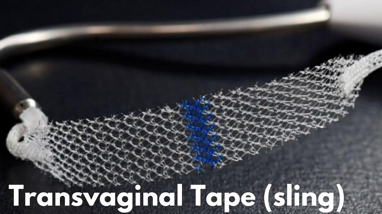 maxresdefault-transvaginal-sling-womancare