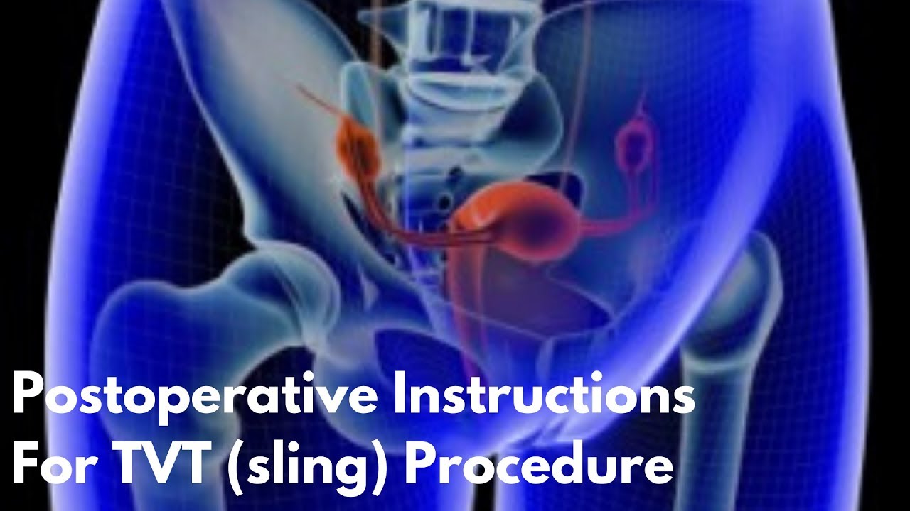 maxresdefault-tvt-post-op-womancare
